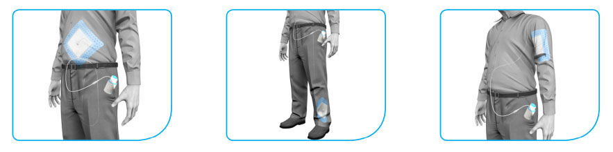 NANOVA THERAPY SYSTEM1