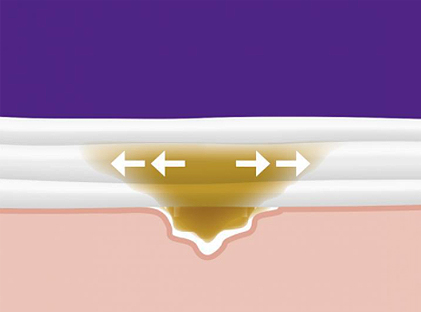 VACUTEX Drainage